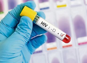 95% de personas con VIH han sido afectadas por el papiloma humano