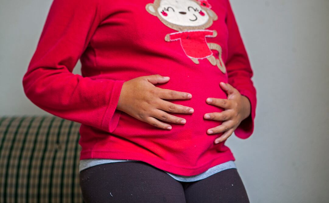 Isabel cuenta con el apoyo de su madre, sus abuelos y el de su padrastro que la ha visto como su hija. En Vifac le enseñan alguna actividad para que pueda mantenerse y le brindan atención sicológica. (Foto: CAMILA MATA)