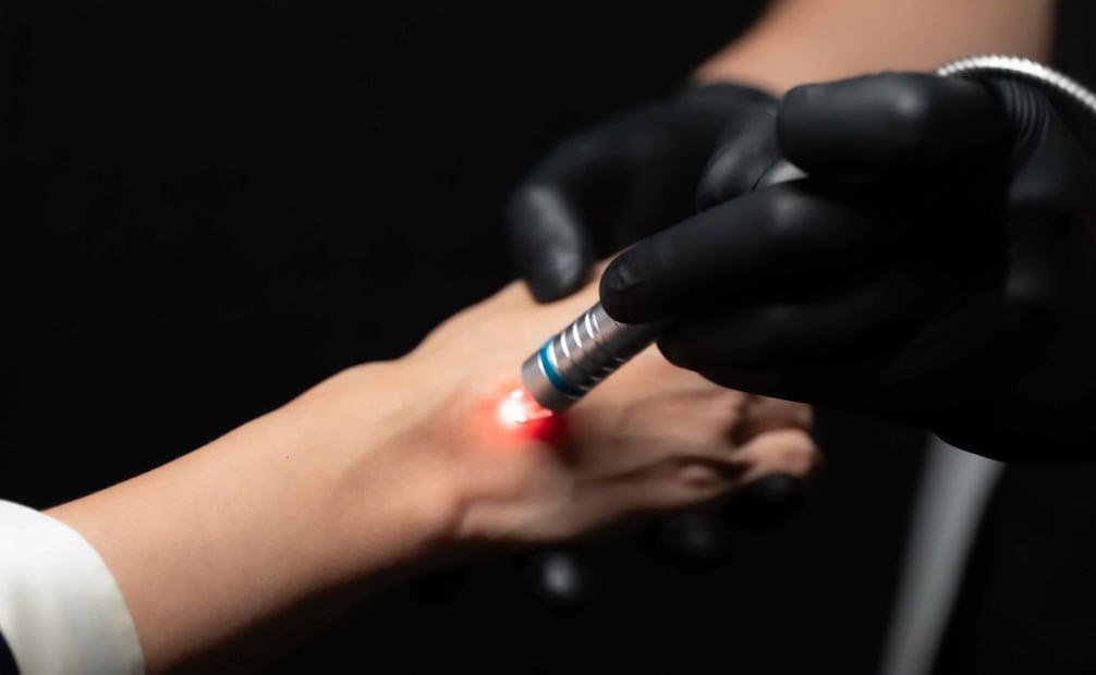 El resurfacing ofrece resultados de manera progresiva, pero notables. Foto: Cortesía