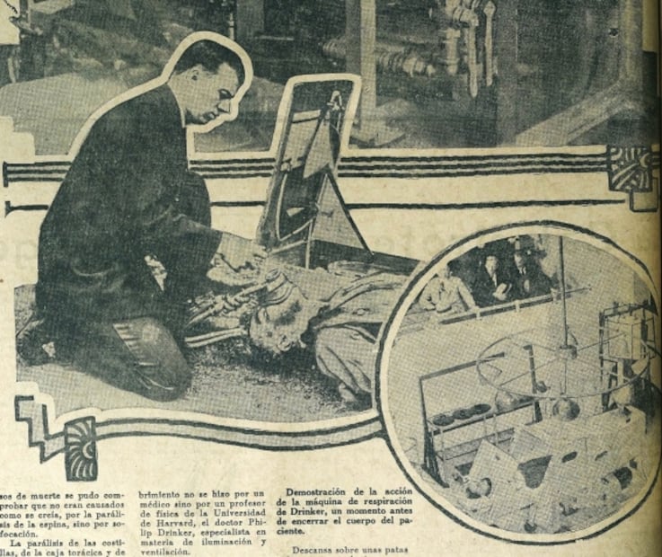Así eran los primeros respiradores artificiales