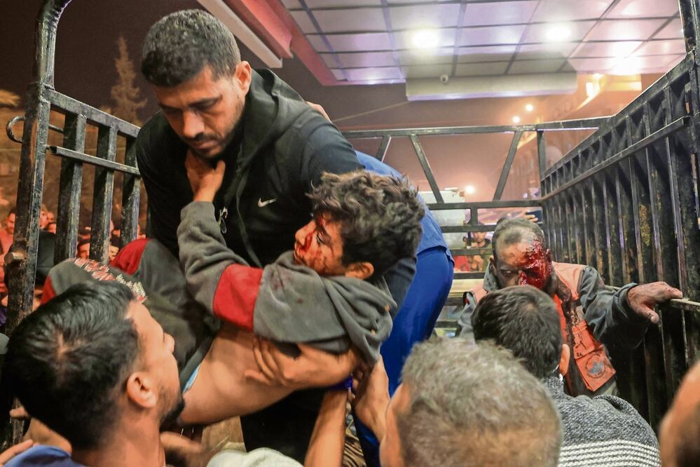 Palestinos heridos durante un bombardeo de Israel llegan al hospital Nasserm en Khan Yunis, en el sur de la Franja de Gaza. Foto: AFP