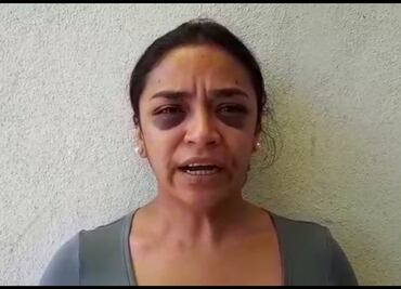 Periodista acusa golpiza de policías al denunciar intento de violación en Morelia