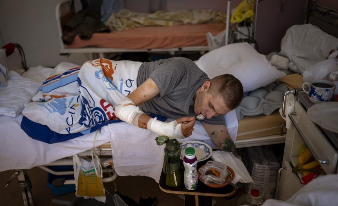 Anton Gladun come como puede en su cama de un hospital de Cherkasy (Ucrania) el 6 de mayo del 2022. Gladun, un médico militar de 22 años, perdió partes de las dos piernas y de un brazo al estallar una mina rusa el 27 de marzo. (AP Photo/Emilio Morenatti)