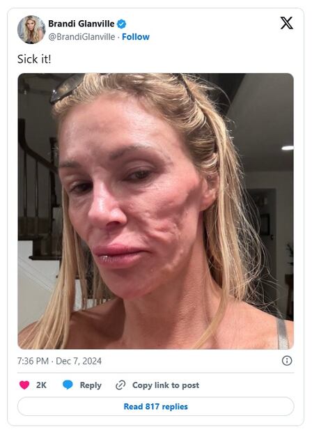 La actriz Brandi Glanville alerta con esta foto de su rostro.