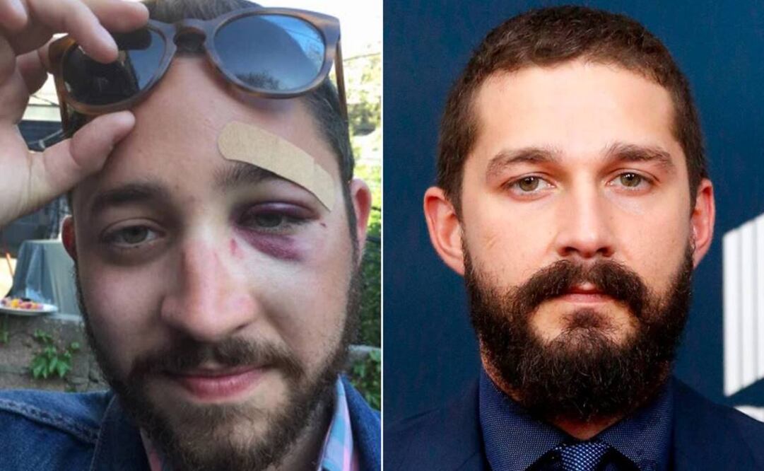 Mario publicó en sus redes sociales una imagen mostrando su ojo hinchado y morado. (FOTO. Especial)