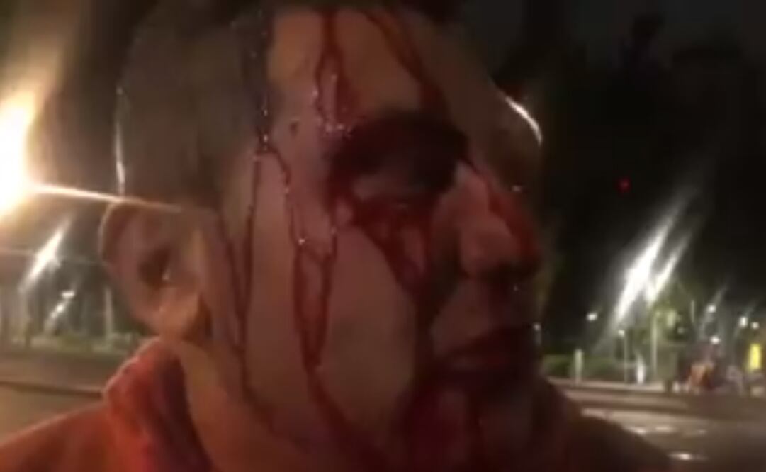 Foto: periodista golpeado en la Doctores. (tomada del video: Cortesía Isidro Corro)