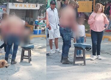 Suman 29 heridos tras explosión de tanque de gas en tianguis de Huehuetoca