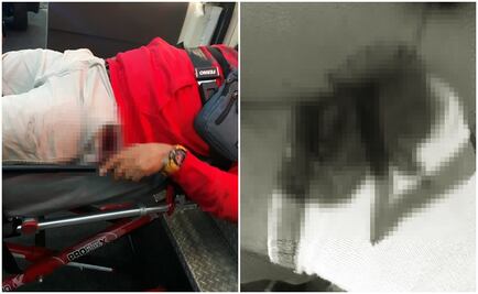 Motociclista balea a joven en Tlalpan por pedirle precaución al manejar