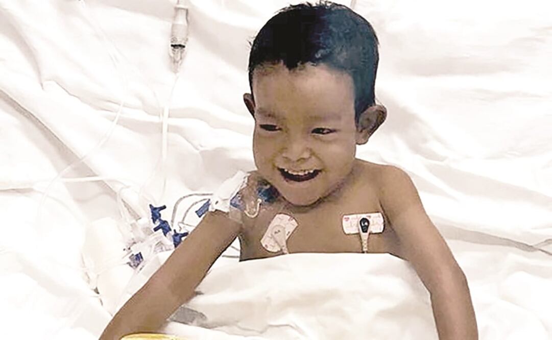 Joshua fue diagnosticado con un trastorno genético de los conductos biliares que provoca cirrosis de forma prematura, su hígado estaba tan deteriorado, que sus médicos le pronosticaban como máximo tres años de vida. Foto: IMSS