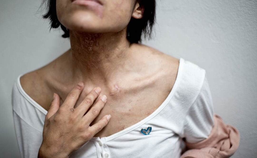 "Ana" estuvo encadenada en una planchaduría durante más de dos años