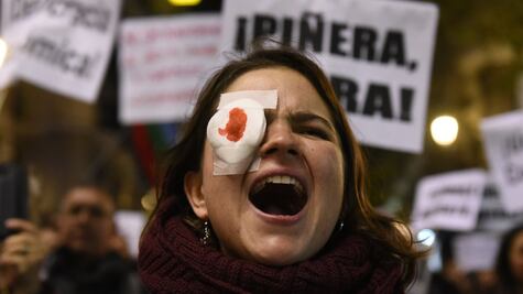 ¿Por qué tantos manifestantes en el mundo sufren lesiones en los ojos?