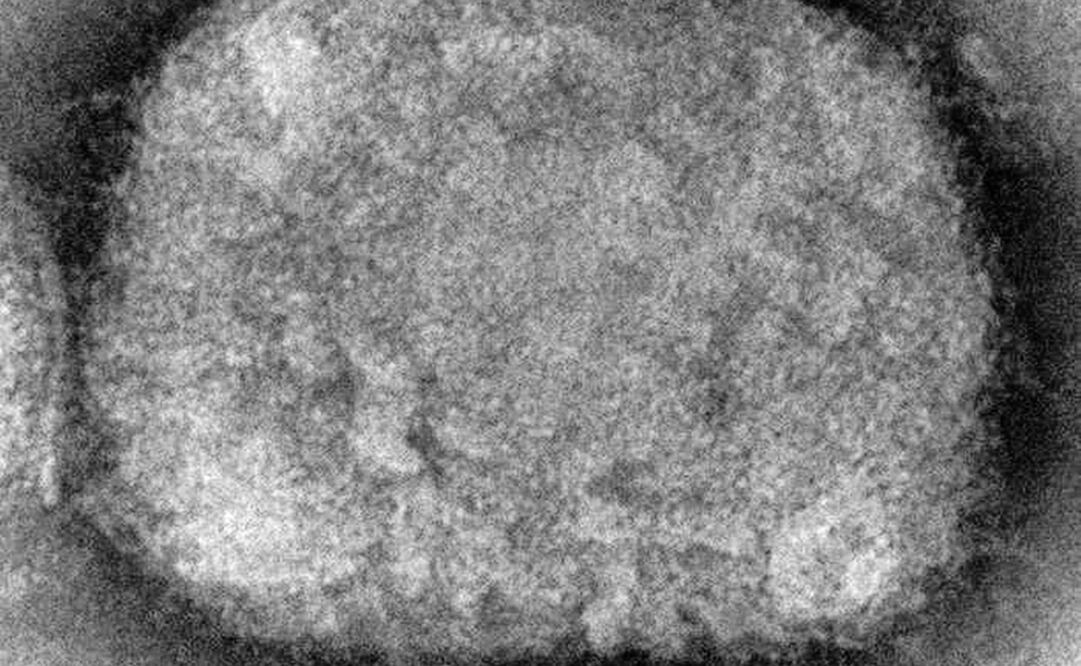 Imagen de microscopio de un virión de la viruela del mono, obtenido de una muestra asociada al brote de perros de la pradera en 2003.  Foto: AP 