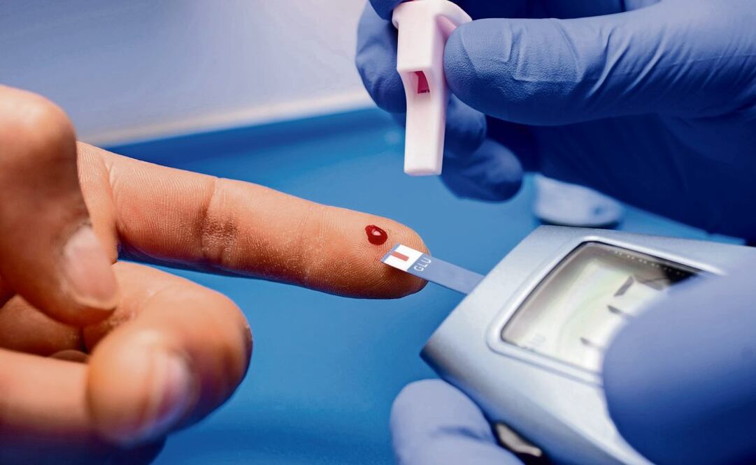 Prueba de glucosa en sangre, fundamental para controlar la diabetes. (21/02/2025) Foto: Especial