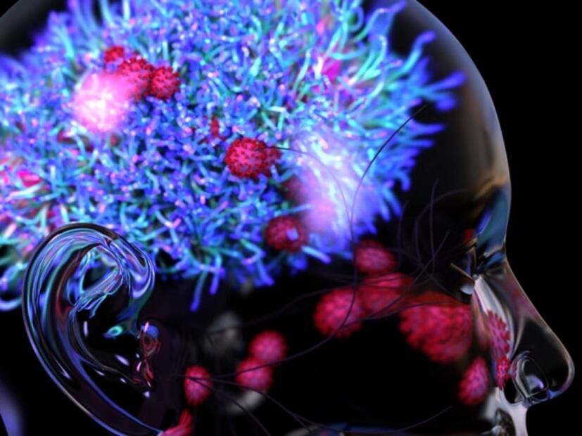 El Covid-19 se puede ocultar en el cerebro y llevar a la muerte, afirma estudio