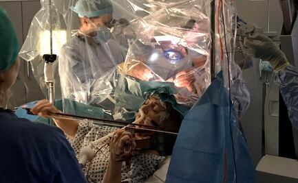 Para salvar sus manos, violinista toca durante su operación de cerebro