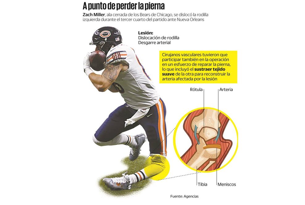 Miller se salva de la tragedia