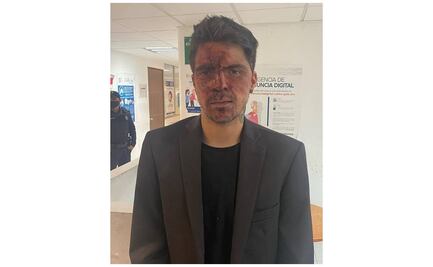 César, hijo de Lupita D'Alessio, denuncia que fue golpeado por Arturo Montiel 