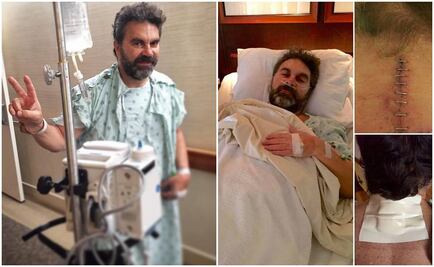 Mijares se recupera de cirugía en la columna