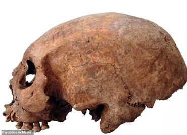 Estudio sugiere que los vikingos ya hacían cirugías plásticas: "alargaban cráneos"