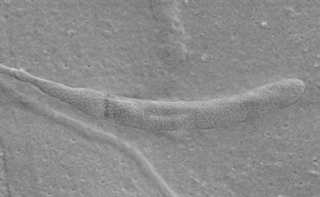 Fosilización se habría producido después de que el esperma quedara atrapado en las paredes del capullo de gusano. Foto: Biology Letters