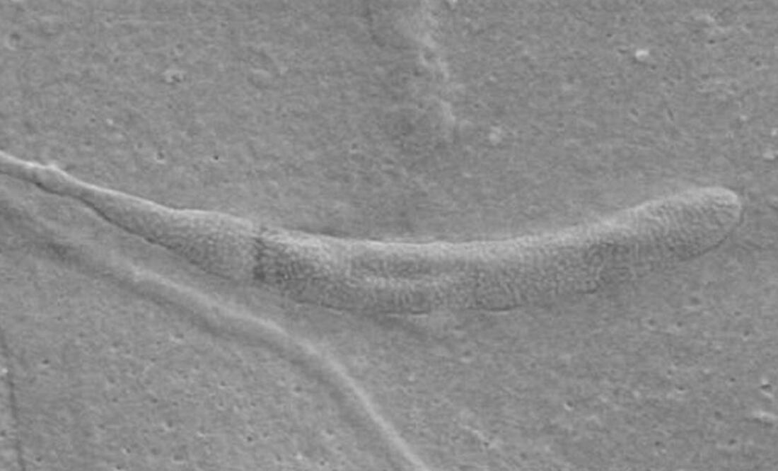 Fosilización se habría producido después de que el esperma quedara atrapado en las paredes del capullo de gusano. Foto: Biology Letters