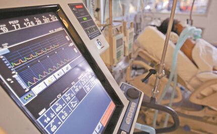 Otros ojos sobre los contratos Bartlett