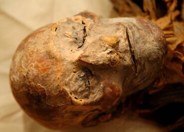 Momias al servicio de la medicina contra la tuberculosis