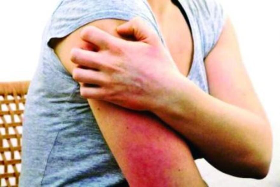 Identifican compuestos para calmar el dolor y el prurito