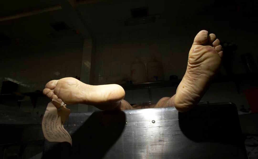 AP/ ARCHIVO HISTÓRICO EL UNIVERSAL