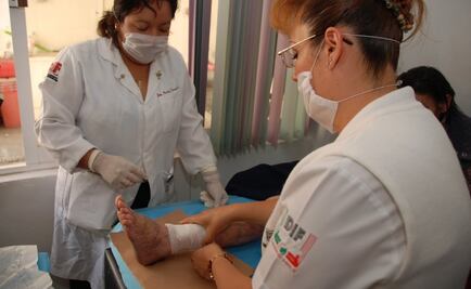 Pie diabético, primera causa de amputación