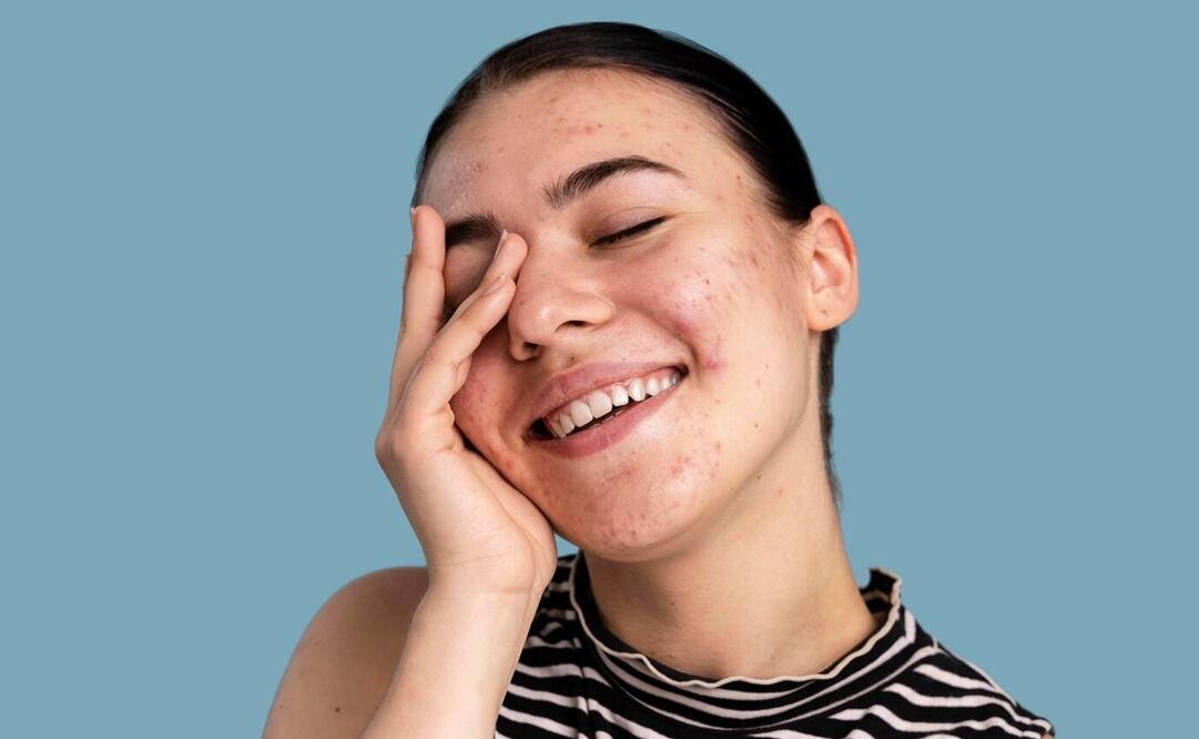 Tónico de jacaranda. Foto: Freepik