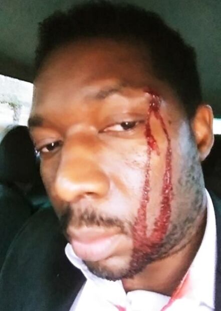 ​“Soy blanca y te puedo matar”, dice salvadoreña a africano en Madrid