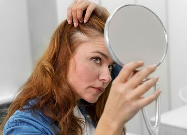 Cómo eliminar el acné que aparece en el cuero cabelludo