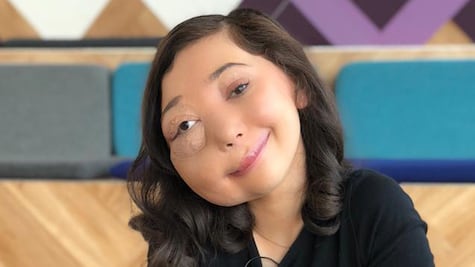 La youtuber con una malformación que será premiada en los BAFTA