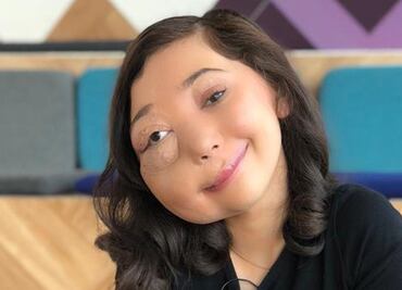 La youtuber con una malformación que será premiada en los BAFTA