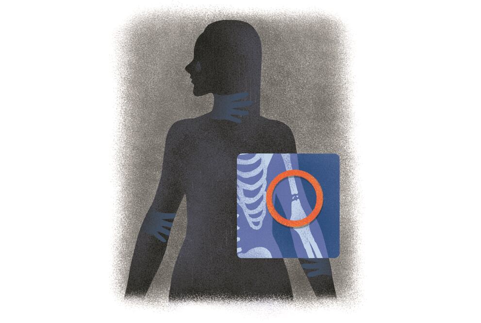 Ilustración: ANI CORTÉS. EL UNIVERSAL