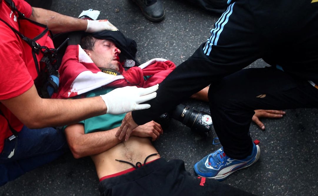 El fotoperiodista argentino Pablo Grillo recibe atención médica por parte de paramédicos tras resultar herido durante una protesta de jubilados, apoyada por aficionados al fútbol, contra el gobierno del presidente Javier Milei en Buenos Aires el 12 de marzo de 2025. Foto: AFP