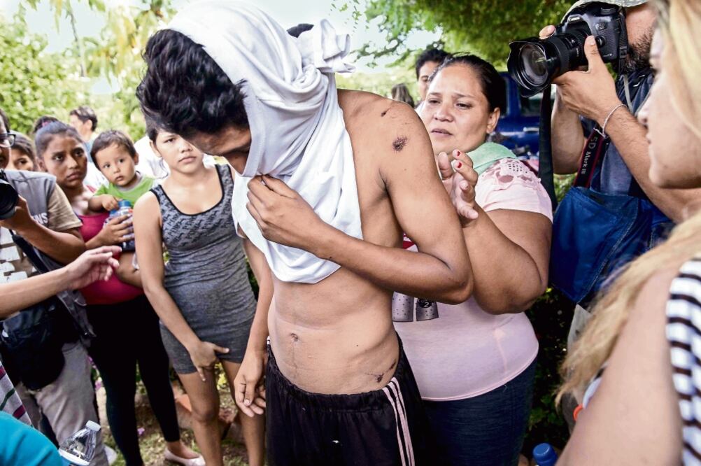 Un joven que estuvo retenido en el penal El Chipote muestra golpes y raspones tras ser liberado y entregado a sus familiares ayer, en Managua (JORGE TORRES. EFE)