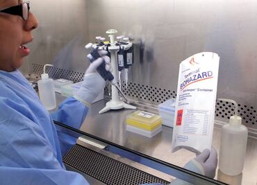 Ganglios linfáticos pueden ayudar a crear vacuna contra VIH