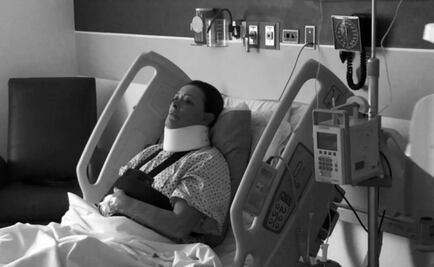 Sylvia Pasquel se dislocó el brazo en el escenario