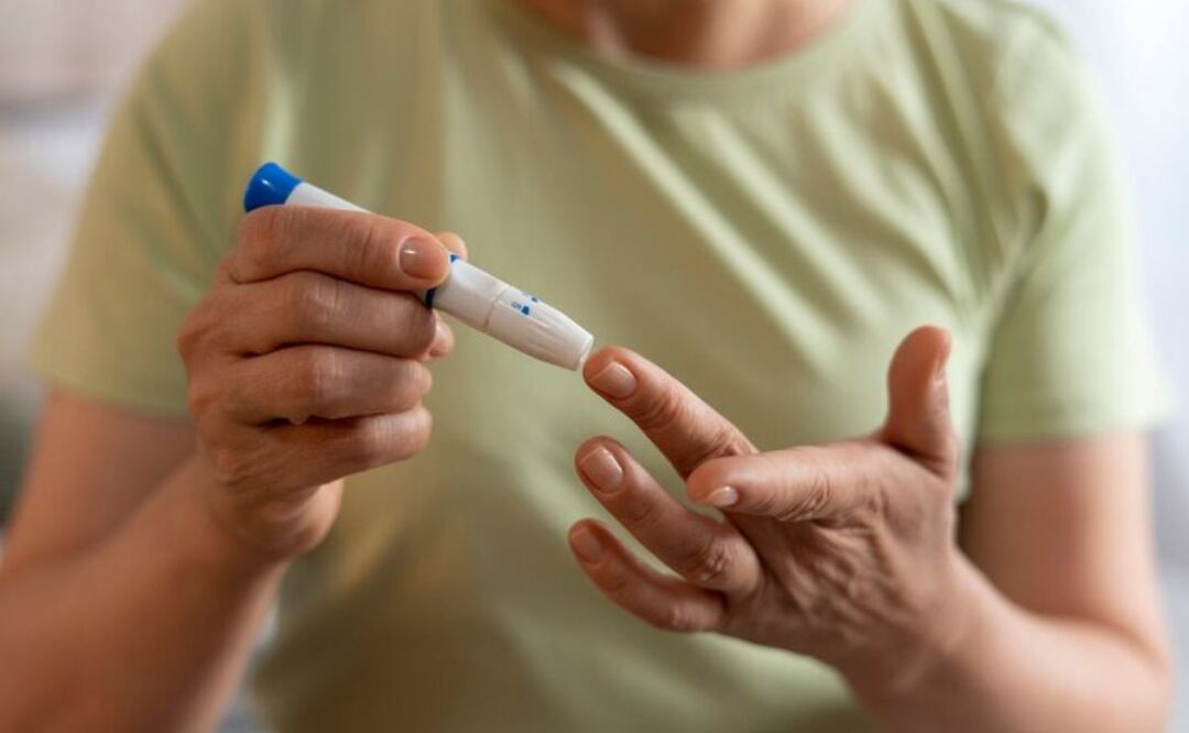 Aunque la fruta es un alimento saludable, los diabéticos deben tener especial cuidado por su alto componente en azúcar. Fuente: Freepik.