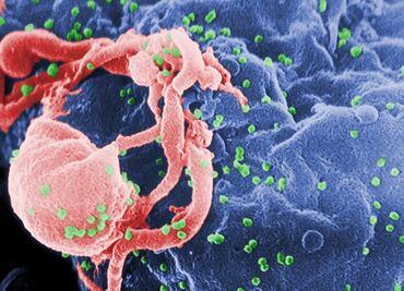 Niña sudafricana no muestra rastro del VIH tras 8 años sin medicación