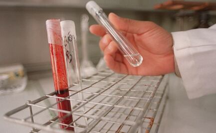 Cuáles son los síntomas del virus mortal parecido al Ébola descubierto en Bolivia