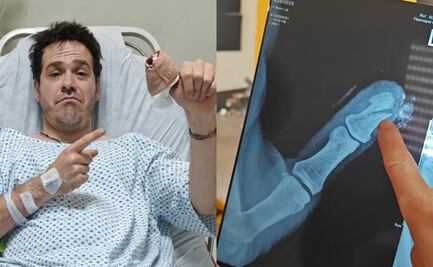 Tiktoker sufre accidente al poner a prueba herramienta de jardinería; “la tijera cortó mi hueso, lo partió en dos”