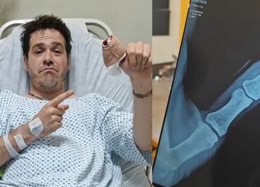 Tiktoker sufre accidente al poner a prueba herramienta de jardinería; “la tijera cortó mi hueso, lo partió en dos”