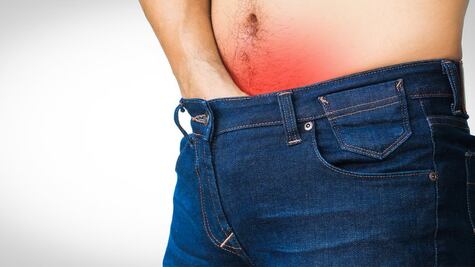 ¿Es posible "revertir" la circuncisión?