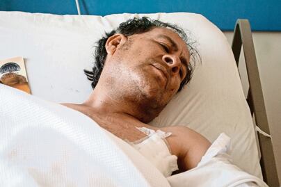 Sobrevive a tres explosiones en el mercado de San Pablito