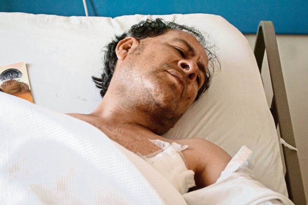 Miguel Urban tuvo fractura de húmero izquierdo, de costillas y quemaduras importantes en su vientre al intentar proteger a su madre del fuego (JOSE ANTONIO TORRES. EL UNIVERSAL)