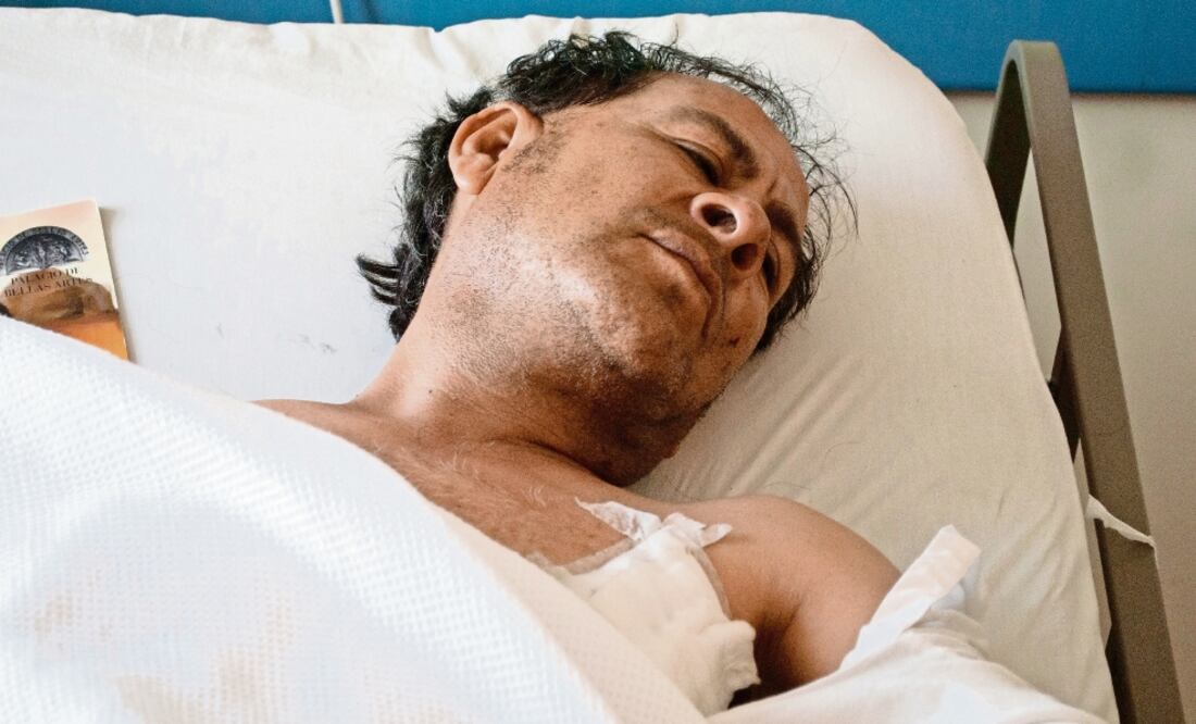 Miguel Urban tuvo fractura de húmero izquierdo, de costillas y quemaduras importantes en su vientre al intentar proteger a su madre del fuego (JOSE ANTONIO TORRES. EL UNIVERSAL)