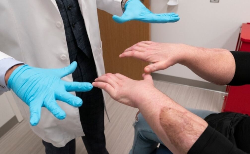 Realizan primer trasplante exitoso de manos y cara simultáneo en Estados Unidos